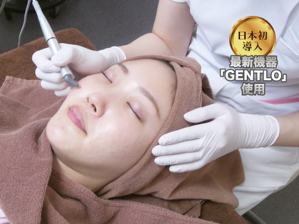 アクネスニードル