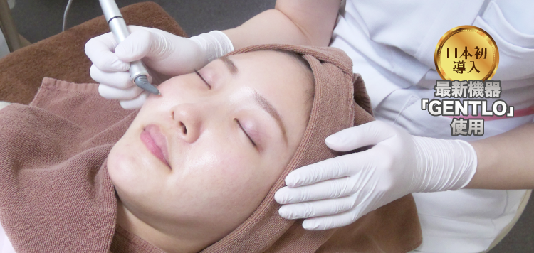 アクネスニードル