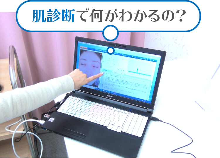 肌診断で何がわかるの？