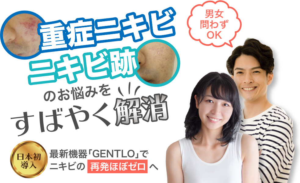 重症ニキビ ニキビ跡のお悩みをすばやく解消