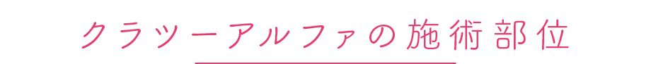 クラツーアルファ施術可能部位