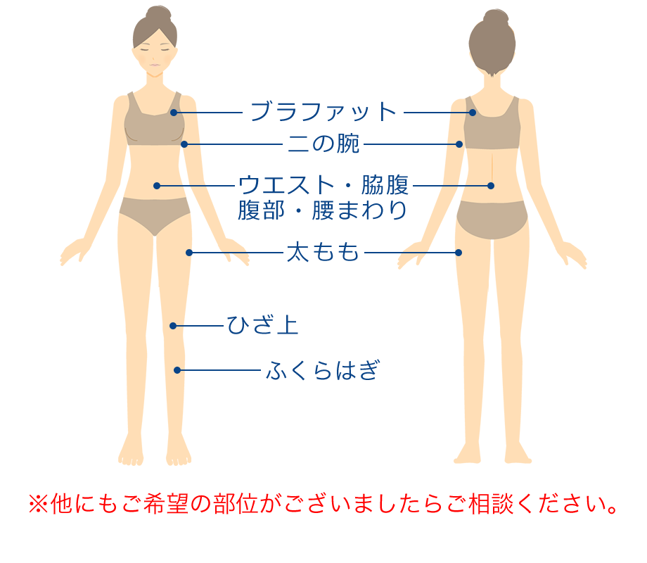 クラツーアルファ施術可能部位イラスト