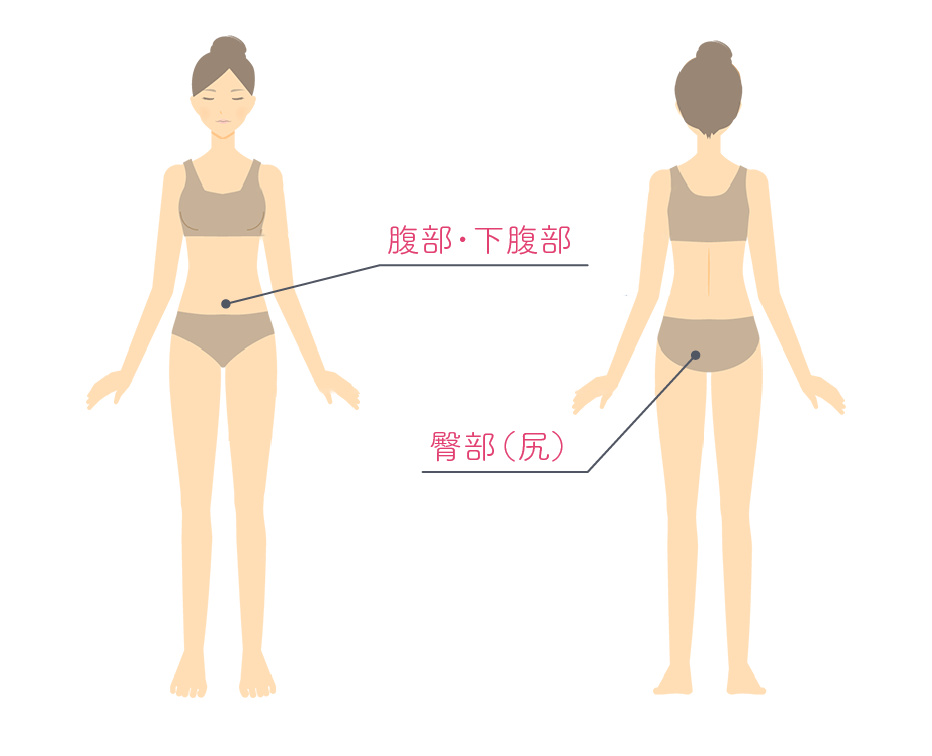クラツーアルファ施術可能部位イラスト