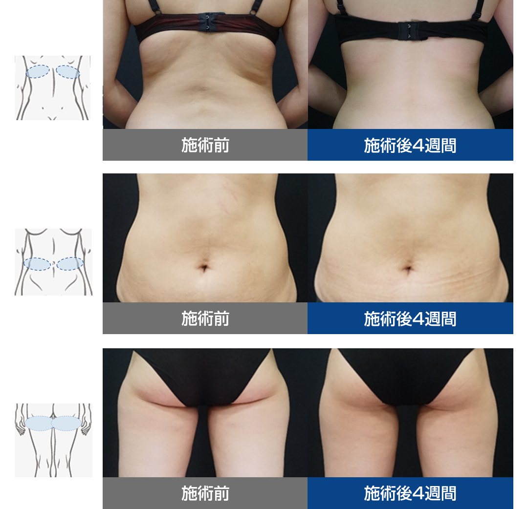 症例写真イメージ