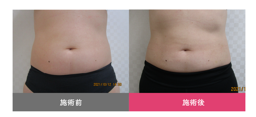 症例写真イメージ