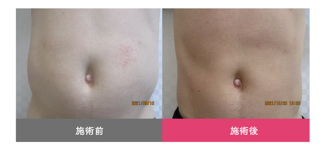 症例写真イメージ