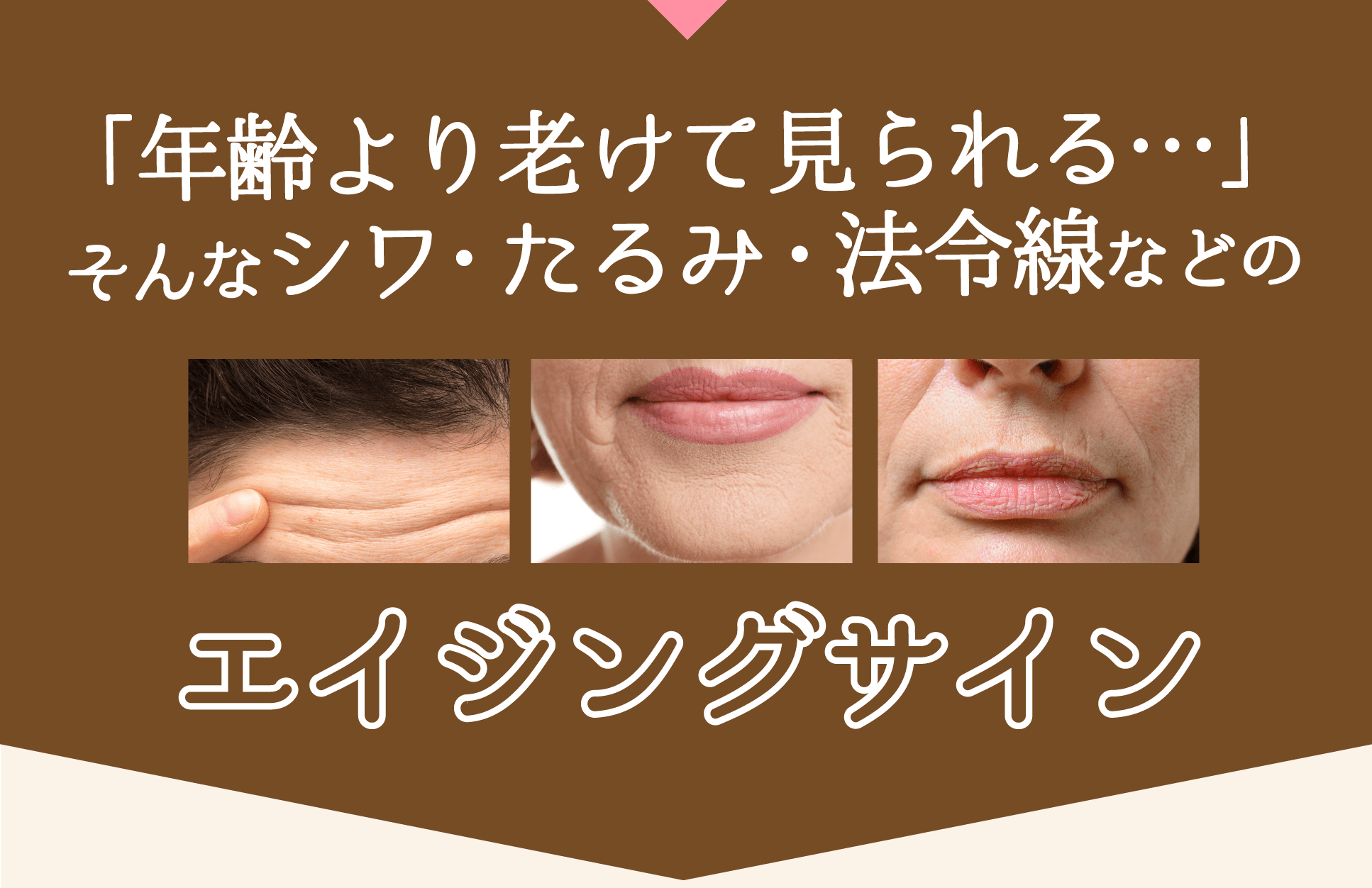 エイジングサイン