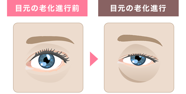 目元の老化進行前、目元の老化進行
