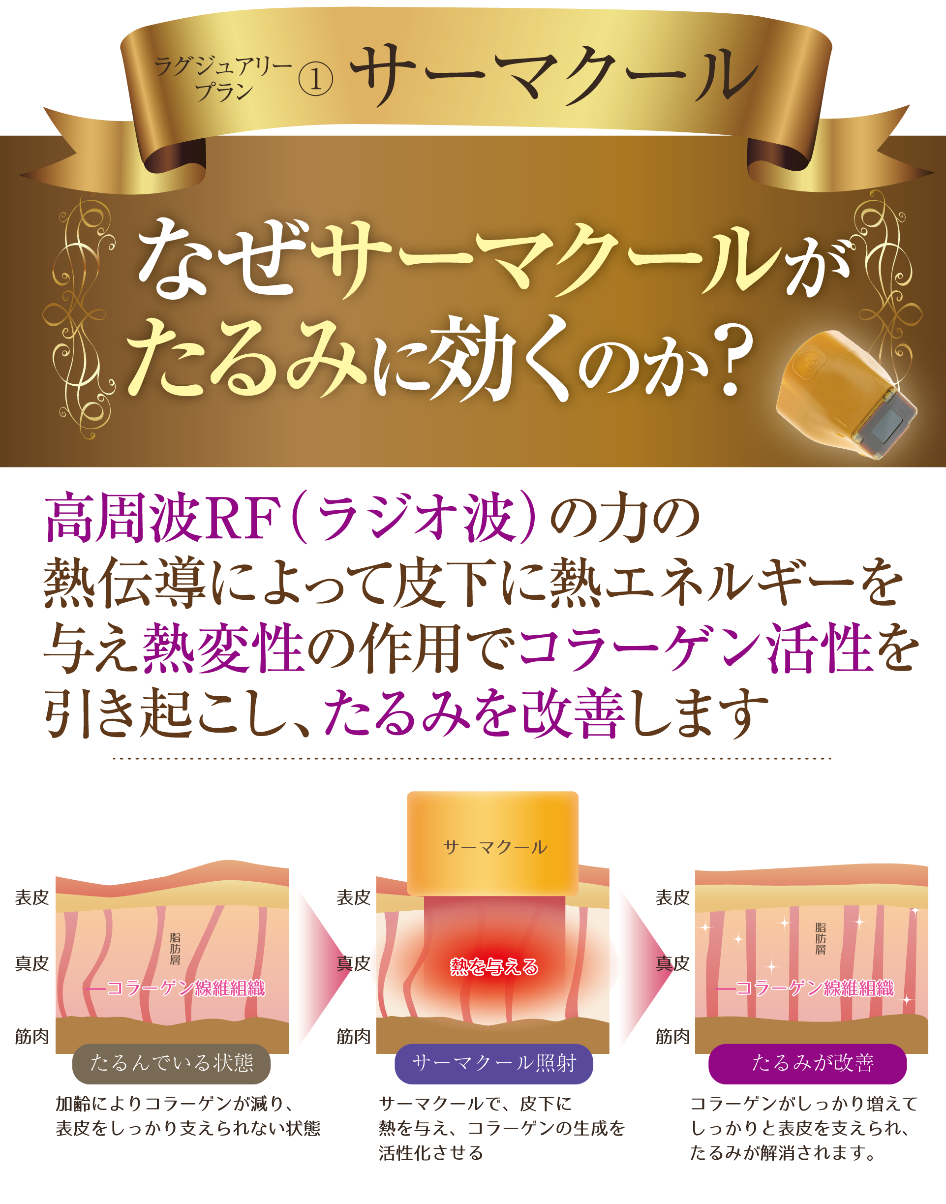 エイジングサイン