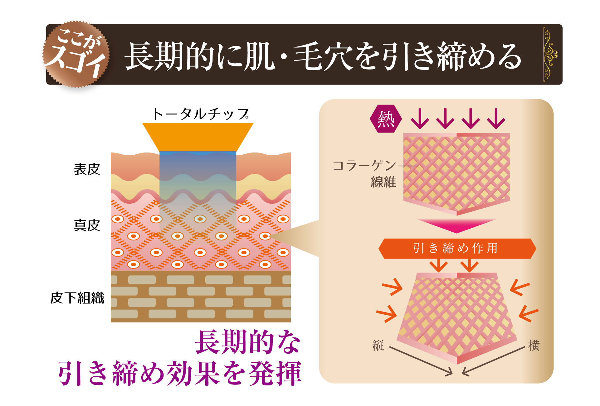 エイジングサイン