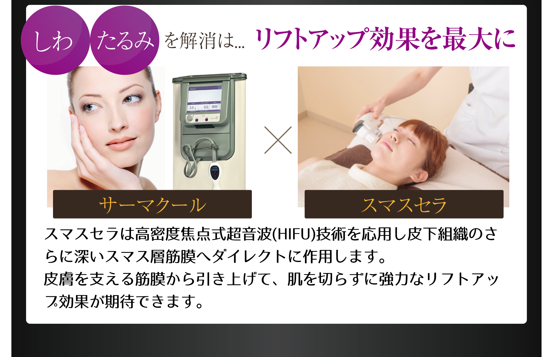 エイジングサイン