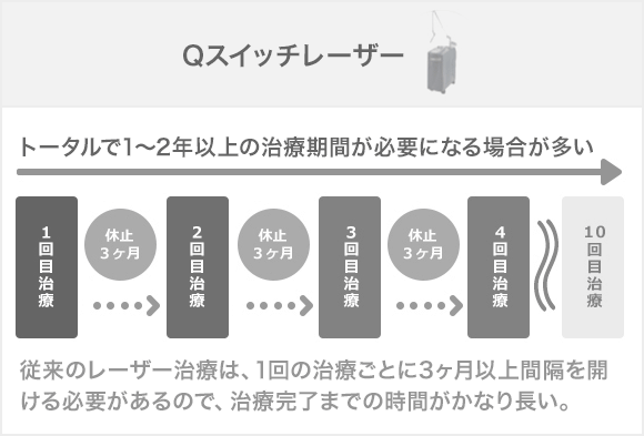 Qスイッチレーザー