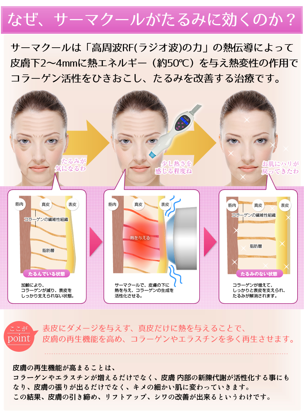 加齢が原因で、たるみや深いしわが目立つようになります。それでは、どういう訳で加齢によりたるみや深いしわができてしまうのでしょうか？それは、皮膚・皮下組織・筋肉の3つの組織の老化が主な原因です。