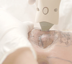 サーマクールアイ