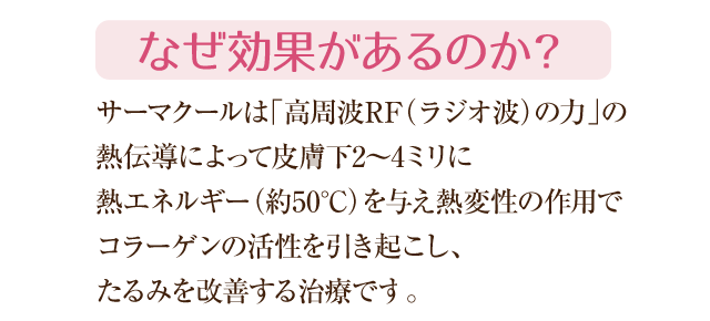 サーマクールは高周波RFの力で皮下に熱エネルギーを与えコラーゲンの活性を引き起こしたるみを改善する治療です