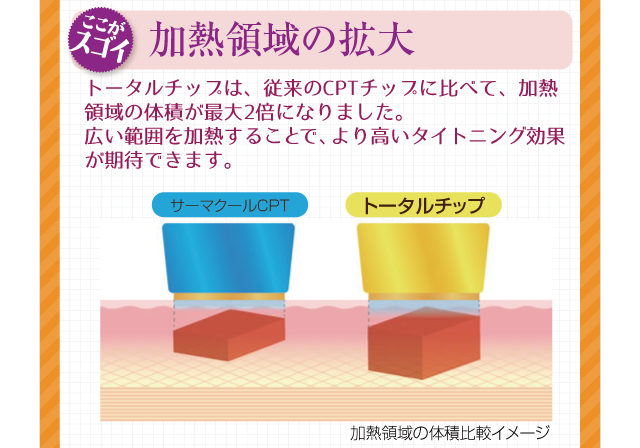 トータルチップは、従来のCPTチップに比べて、加熱領域の体積が最大2倍になりました。広い範囲を加熱することで、より高い体とニング効果が期待できます。