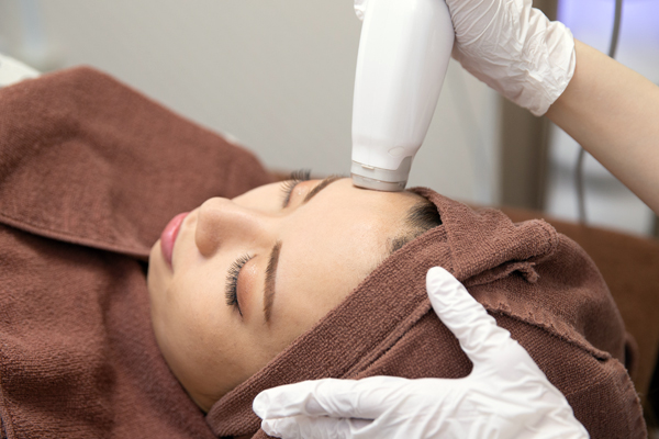 GENTLOプラズマの施術の様子