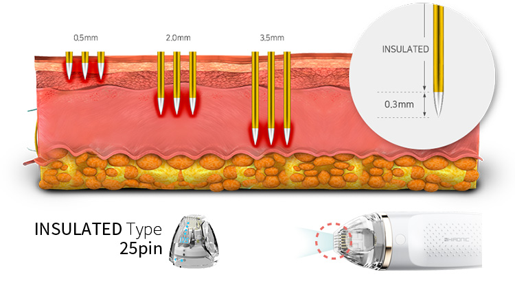 ジェントロアクネスマルチニードル