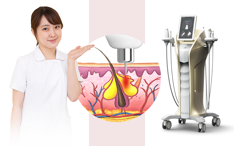 アクネスニードルの機器を紹介