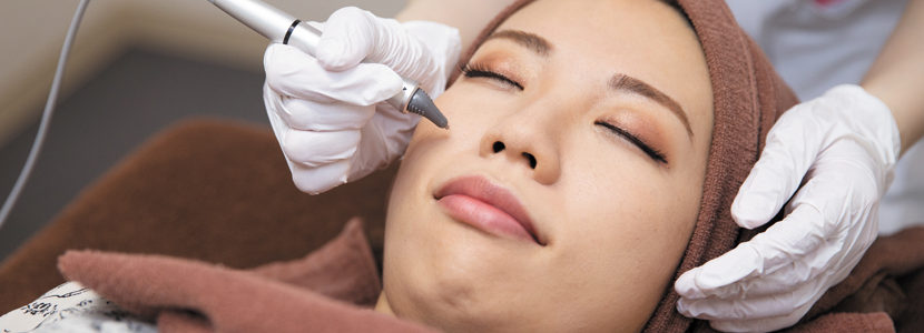 アクネスニードル