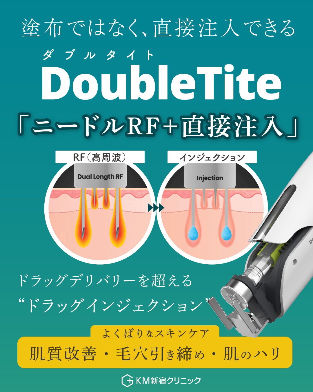 DoubleTite（ダブルタイト）を導入しました。 ｜KMクリニック（新宿）